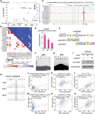 Large Multicohort Study Reveals a Prostate Cancer Susceptibility Allele at 5p15 Regulating TERT via Androgen Signaling-Orchestrated Chromatin Binding of E2F1 and MYC